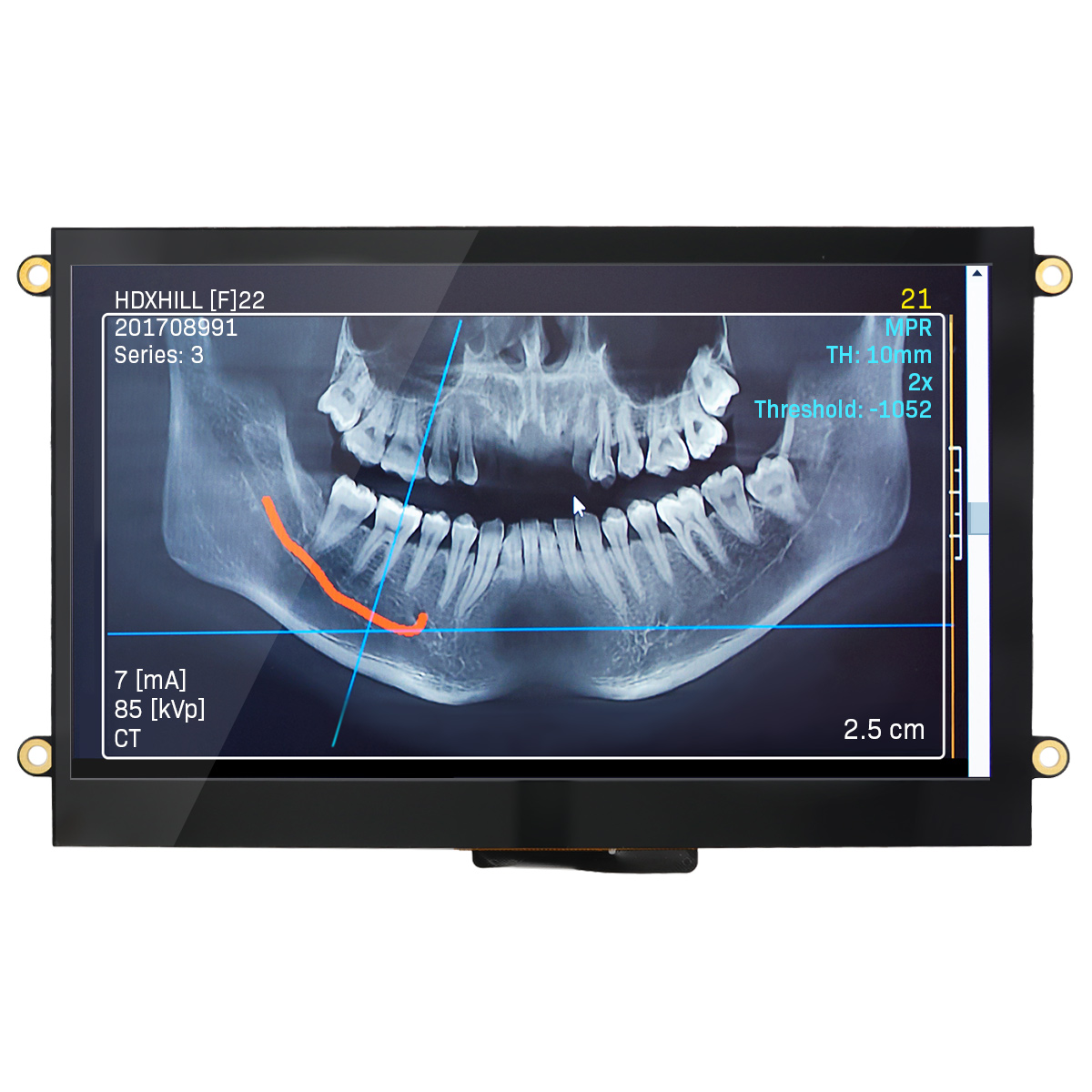 Newhaven Display Intl NHD-7.0-800480FT-CSXP-CTP electronic component